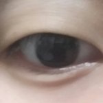 [조언부탁] 쌍수고민