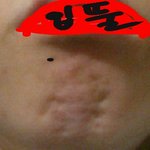 [댓글부탁] 턱에 이거 나만 이런거임?