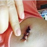 사진有 이것도 <b>의료</b>사고 아닌가요..ㅠㅠ