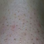 [조언부탁] 얼굴에 딸기<b>농사</b> 지은거 어때요??