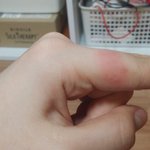 [EXO] 야 나 손가락 이상함;