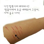 [조언부탁해] 안녕!혹시 리스트컷 증후근알어..?