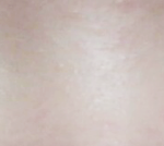 [댓글부탁해] 사진유)<b>쌍수</b>붓기진짜없는데괜찮은거야?