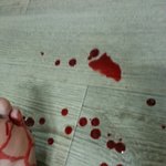 [EXO] 얘들아 나 이거 응급실가야되니...