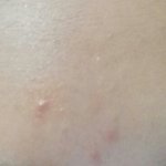 [알려주세요] 피부트러블ㅠㅠㅠㅠ