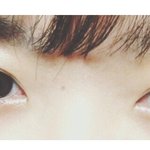 [댓글부탁해] 눈 <b>미간</b>??