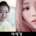 <b>이성경</b> 성형전