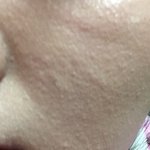 [개깊은빡침] 방법없나요ㅠㅠㅠㅠ