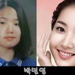 [공포] <b>여자</b>연예인 성형<b>전</b>...개충격(사진ㅇ)
