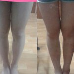 [다이어트팁] (추가)<b>하체</b>비만. 허벅지 뺐어요 사진有