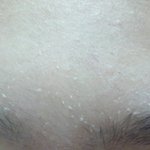 [혐오주의] 나만 이마나 코에 이래..??