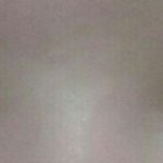 쌍꺼풀 재수술 해야할까요 ㅠㅠㅠ (사진있음)