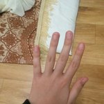 <b>손톱</b>을 많이물어뜯는데 어쩌지