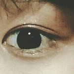 [EXO] 혐)이거 쌍수성공한거같아? <b>추반</b>좀