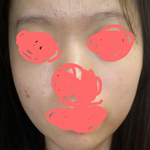 <b>극혐</b>주의 나 좆됫어 ㅅㅂ