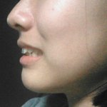 [댓글부탁해] <b>이빨</b> 많이 거슬려보여?? 교정할까???