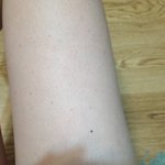 [댓글부탁해] 뱀살 <b>닭살</b> (사진 유) 조금 혐오