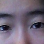 쌍수를 할까요 ??