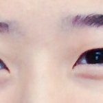 [조언부탁] 쌍수 <b>전후</b> ㅠㅠ 도와줘요