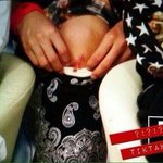 [EXO] 타오 스플래시에서 다쳤을때