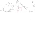 [드루와] 18세 여고딩 <b>항문</b>외과 후기..