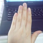 아까 <b>손</b> <b>사진</b> 올렸던 앤데