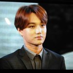 [EXO] 종인이 머리부상인줄 알았는데 헐
