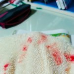 [EXO] ㅅㅂ 수건에 피묻어서 조카 놀랐네