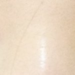 [댓글부탁해] <b>삼백</b>안 교정법좀ㅠㅠ 너무 싫다