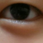[댓글부탁해] <b>쌍수</b>할까요ㅠ