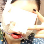 [EXO] <b>성형</b> 후기..