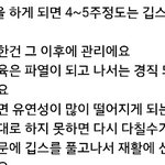 [EXO] 인대<b>파열</b> 검색해보면 심각하긴하드라