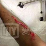 [EXO] 타오 <b>부상</b>말인데