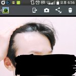 이런머리형이 <b>탈모</b>인가요?