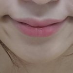 [늙은입주름] 웃을때 입주름근육 어떻게 해야하나요 ㅠㅠ