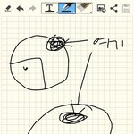 [조언부탁해] 야 나 <b>뇌진탕</b>인가?ㅜㅠㅠㅠ