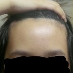 [드루와] 나보다 <b>이마</b>넓은사람드루와ㅋㅋㅋㅋㅋㅋ