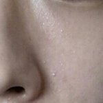 [조언부탁] 제 피부인데 이거 뭔가요?? 혐 주의