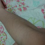 [도와주세요] 초6 팔 <b>다리털</b>..혐오주의ㅠㅠ