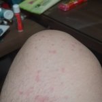 <b>전자</b>담배 부작용인가요??
