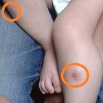 아토피가 있는 아기 <b>녹차</b>로 목욕하고 그러면 좋을까요?