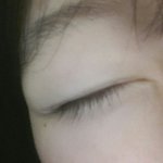 [댓글부탁해] <b>눈</b> <b>옆</b>에 점 뺄까? 안좋은거라던데..