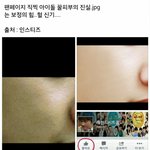 [EXO] 좁꺼비 피부<b>실체</b>