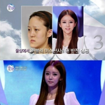 렛미인성형외과