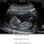 낙<b>태아</b>를 직접 치우는 일을 했던 간호사가 쓴 글