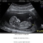 낙<b>태아</b>를 직접 치우는 일을 했던 간호사가 쓴 글