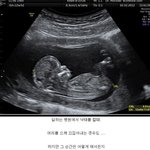 [방탈죄송] <b>낙태</b>하실분들 이글 한번 읽어보세요