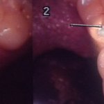 김해에서 치과<b>진료</b><b>후</b> 총견적 242만원이 수원 치과가니 7만원이네요...