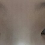 [댓글부탁해] 나<b>쌍수</b>할까말까ㅠㅠ 추반좀..