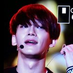 [EXO] 종대 <b>소환</b>하지마 병신들아